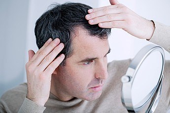 A man examines his receding hairline. Source: medicalimages.com