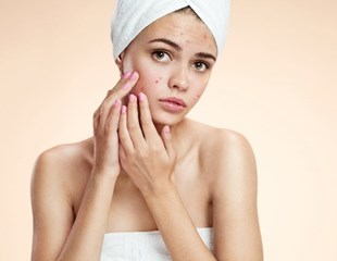 A girl in a towel squeezing spots